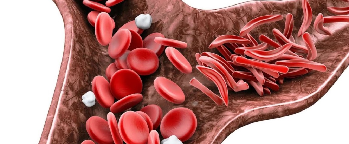 гематология