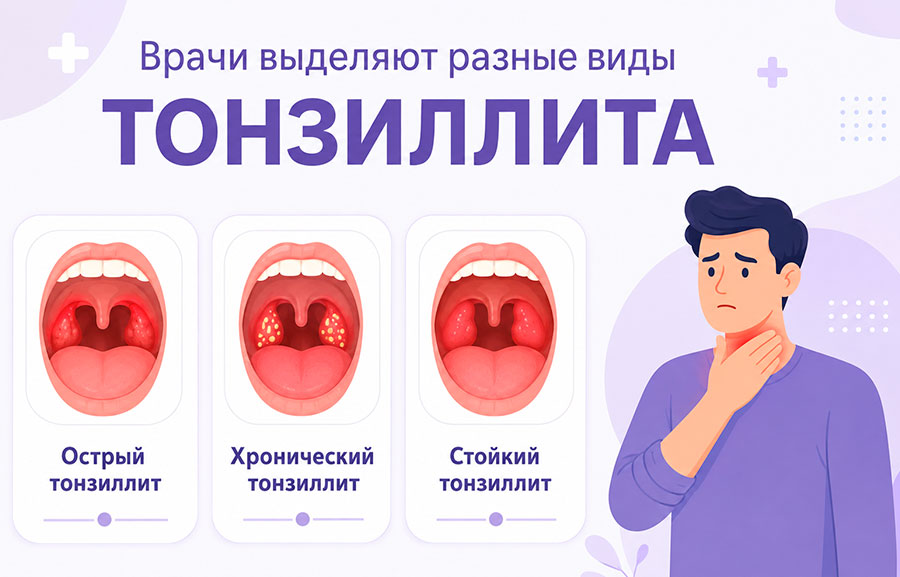 Тонзиллит: что это такое и как его лечить рекомендует врач клиники Линия Мед города Мытищи